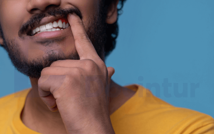 Gum Disease